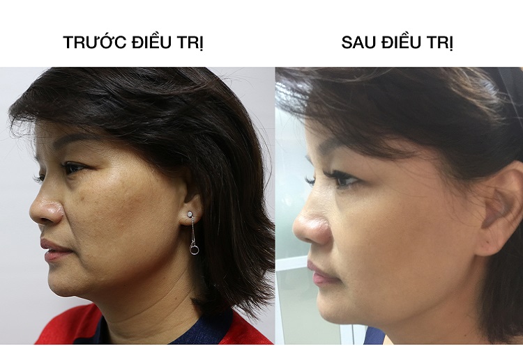 Sakura Active Brightening Complex và Sakura Physical Daily Defense lần đầu tiên được Bệnh viện Da liễu Trung Ương chứng nhận hiệu quả Sakura Active Brightening Complex và Sakura Physical Daily Defense lần đầu tiên được Bệnh viện Da liễu Trung Ương chứng nhận hiệu quả